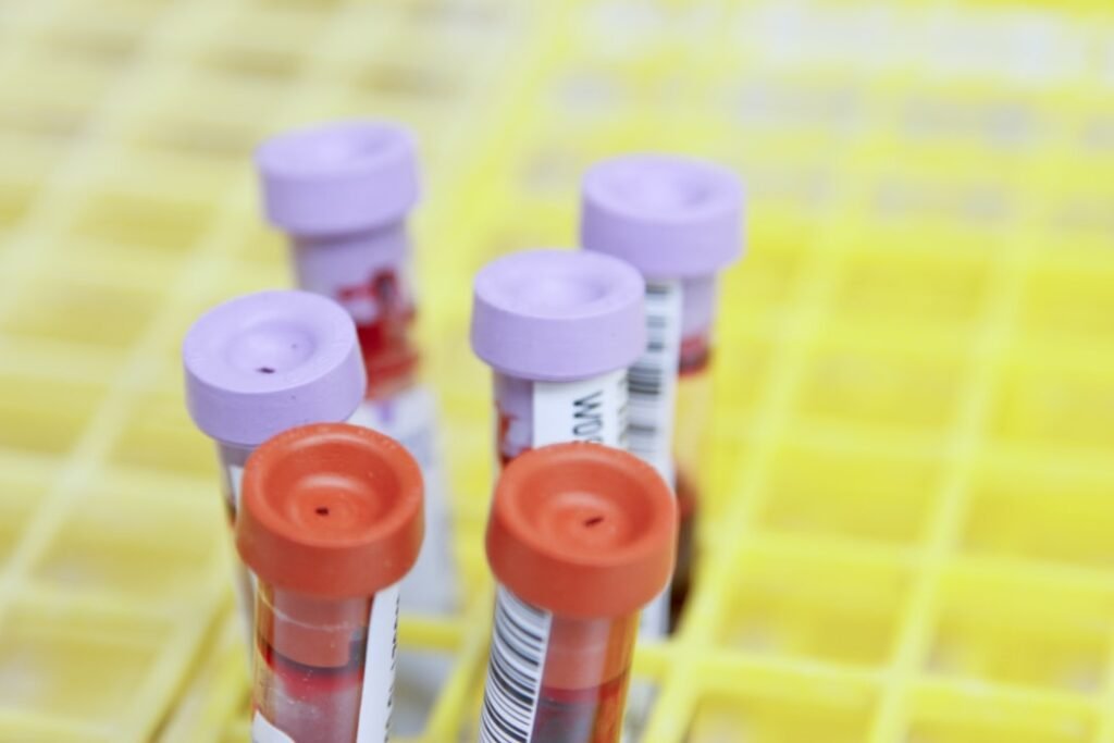 Blood sample tubes used for lipid panel testing