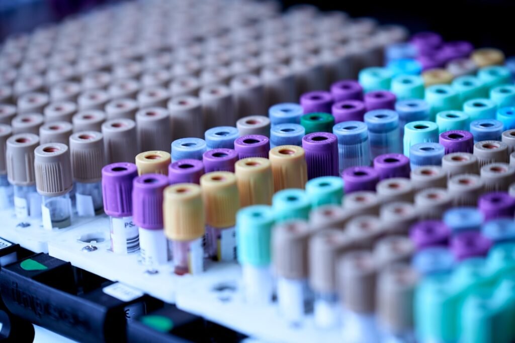 Blood sample tubes prepared for laboratory hormone testing