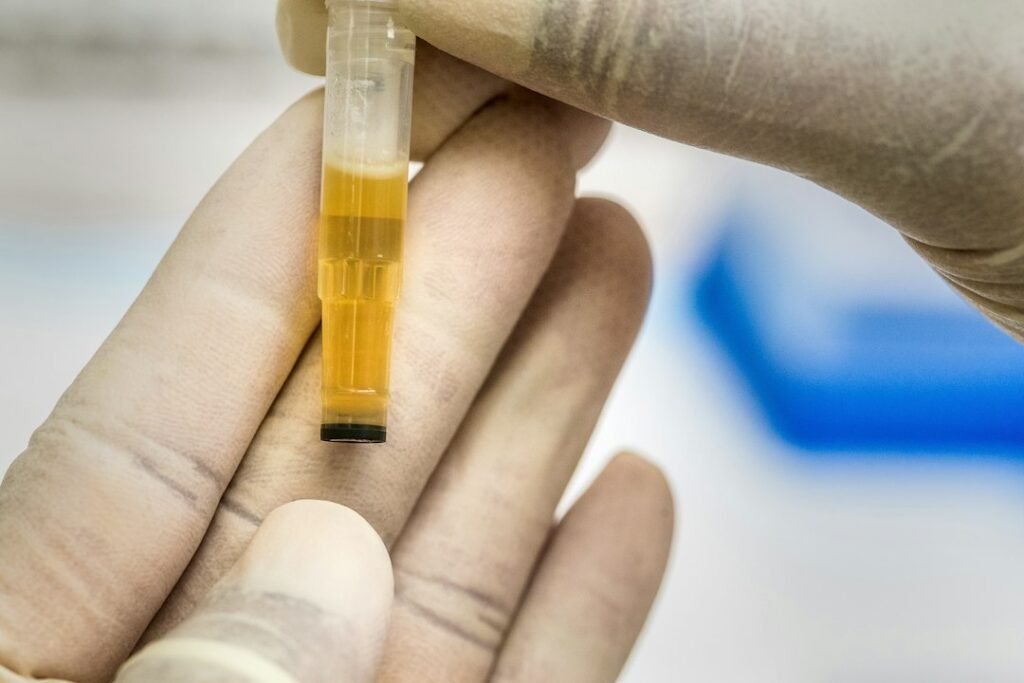 Blood sample prepared for laboratory cholesterol testing and TRT monitoring