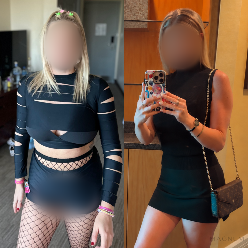 Before-and-after photo comparison shared by a Magnum Health patient receiving semaglutide care.