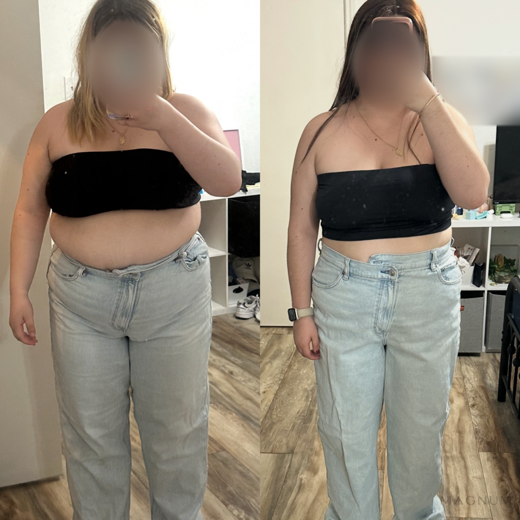 Before-and-after photo comparison shared by a Magnum Health patient receiving tirzepatide care.