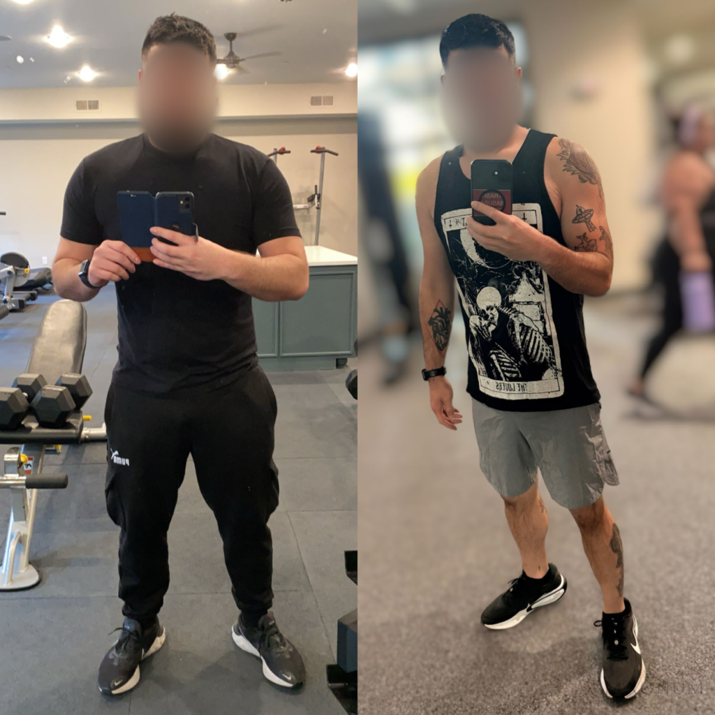 Before-and-after photo comparison shared by a Magnum Health patient receiving tirzepatide care.