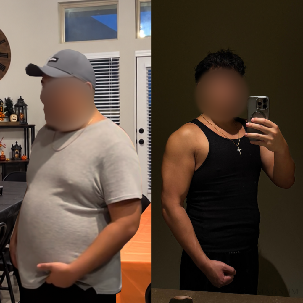 Before-and-after photo comparison shared by a Magnum Health patient receiving semaglutide care.
