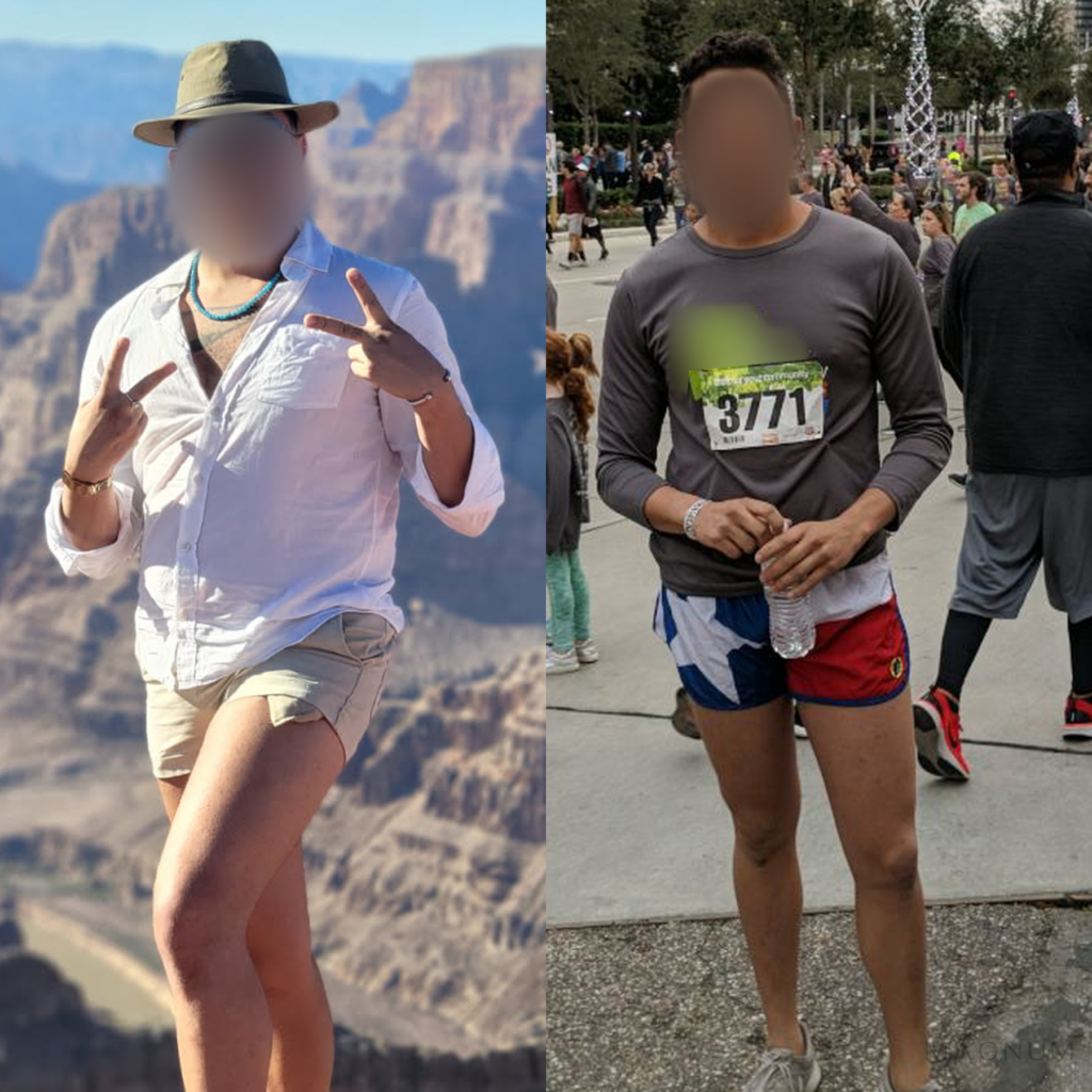 Before-and-after photo comparison shared by a Magnum Health patient receiving semaglutide care.